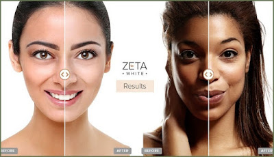 Zeta White 100% Natural Skin Lightening Cream Solution