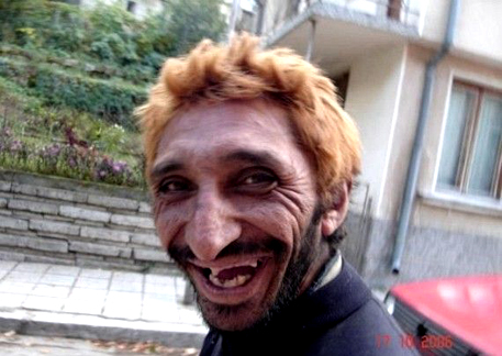 http://2.bp.blogspot.com/-tsnMuUbYLo4/T9xUa6BnnbI/AAAAAAAADIU/lVWiOnaheQw/s1600/Funny+faces+pictures+of+ugly+man.jpg