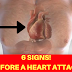 A MONTH BEFORE A HEART ATTACK, YOUR BODY GIVES YOU A WARNING – THESE ARE THE 6 SIGNS!