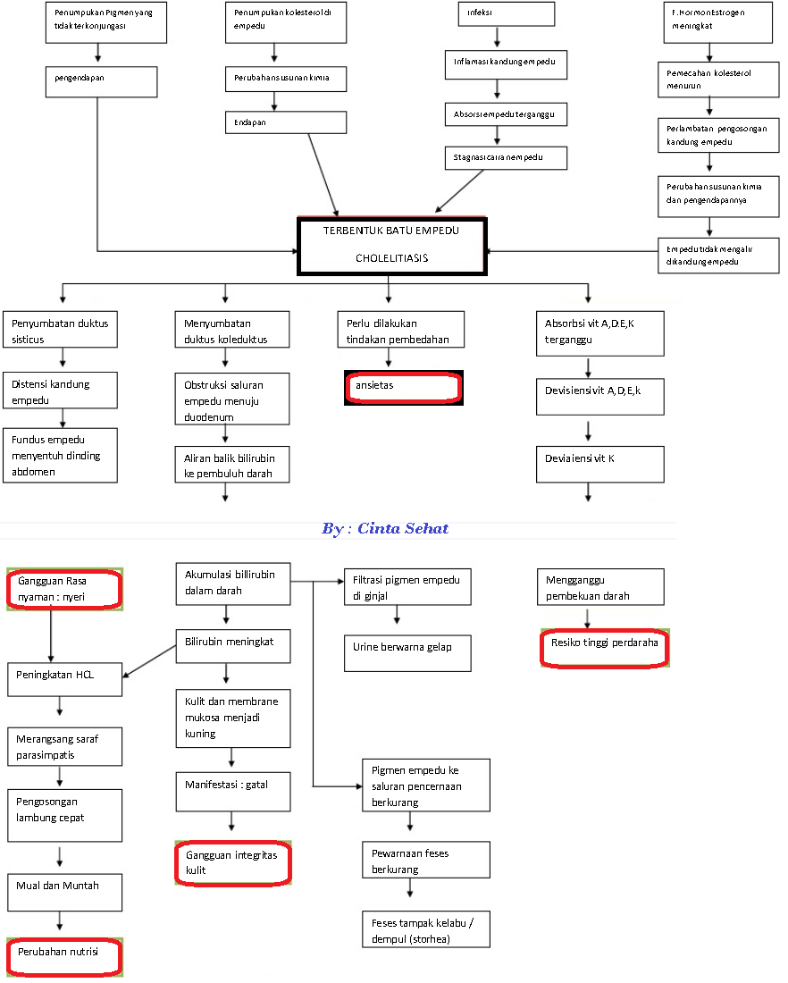 Cholelithiasis (Batu Empedu) Pengertian, Penyebab