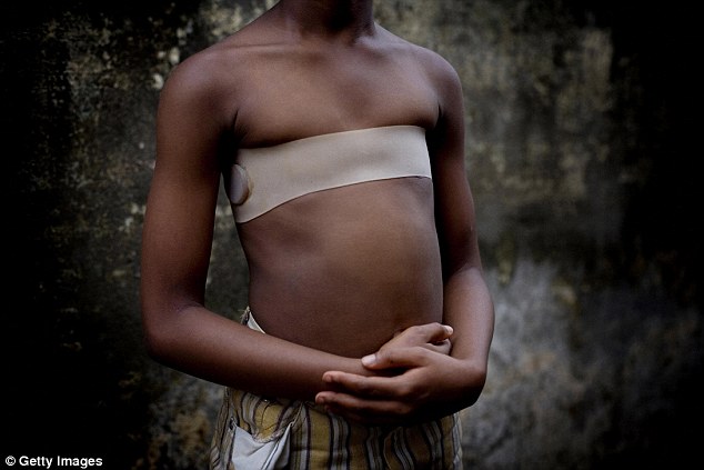 Breast Ironing in Africa