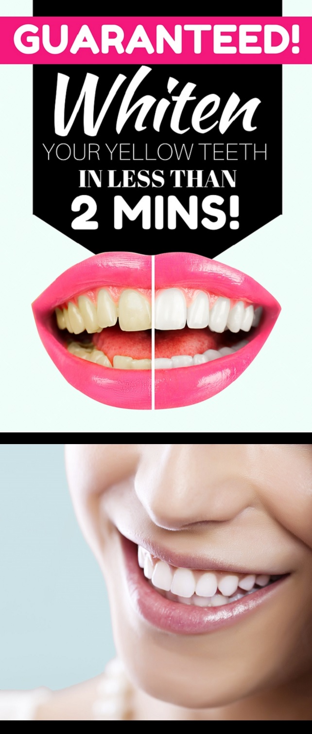 GUARANTEED! WHITEN YOUR YELLOW TEETH IN LESS THAN 2 MINUTES! HEALTH ROOTS