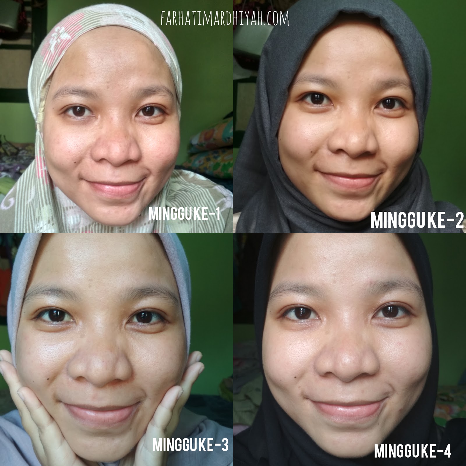Review Avoskin Miraculous Refining Serum, Exfoliator Untuk Acne Prone