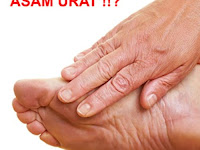 Obat Untuk Penyakit Asam Urat Dan Rematik