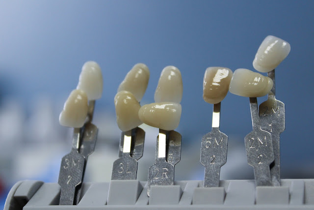 Tooth crown for dental implants