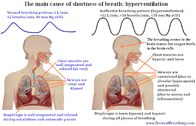 shortness of breath after surgery