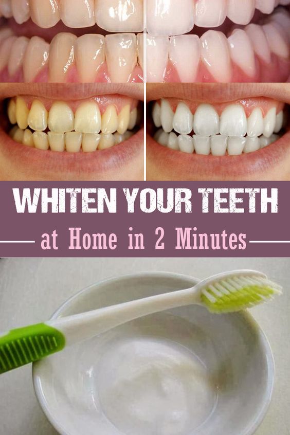 Use Baking Soda To Get Super White Teeth