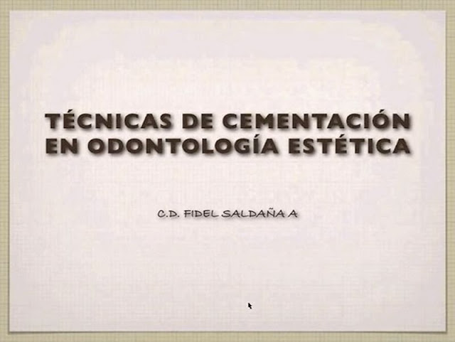 CEMENTACIÓN ADHESIVA: Técnicas de cementación en Odontología Estética - Dr. Fidel Saldaña