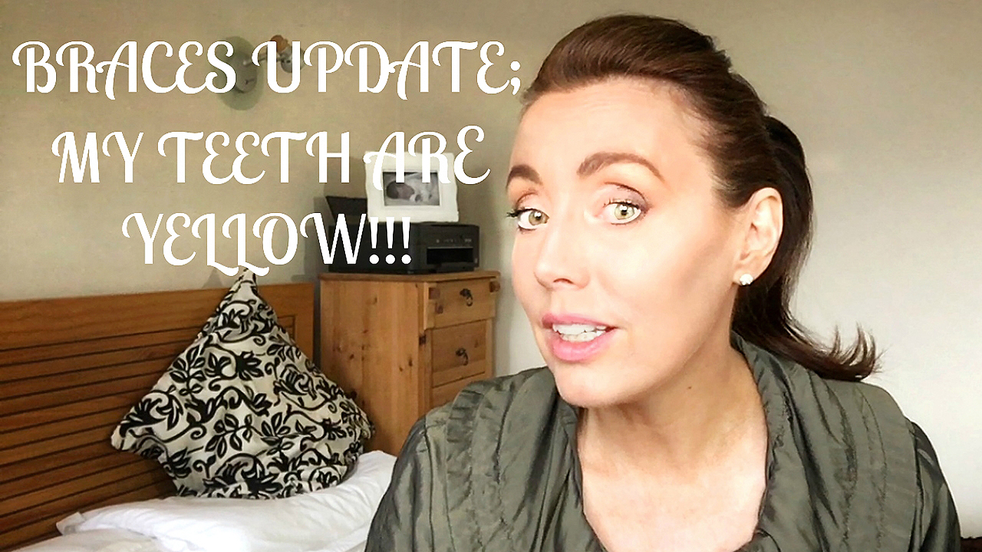 braces teeth update yellow gone adult