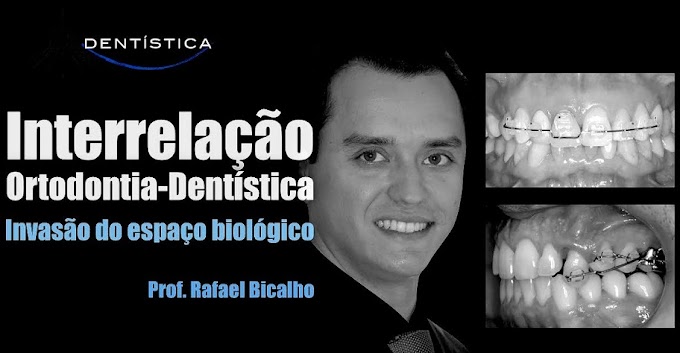 Interrelação ORTODONTIA - DENTÍSTICA (Prof. Rafael Bicalho) - Invasão do Espaço Biológico