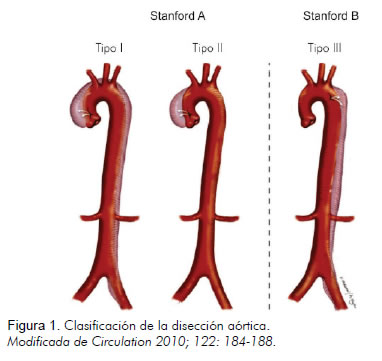 Medicina - facilitando fontes: ANEURISMA/DISSECÇÃO DE AORTA