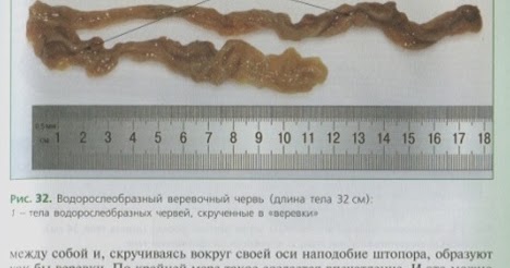 пижма и полынь от паразитов как принимать пижма и полынь от паразитов как принимать