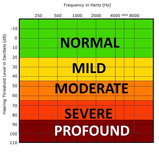 April 2017 Eartistic Hearing & Balance Centre