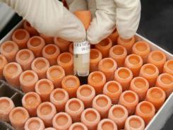 las células madre pueden revertir la diabetes tipo 1