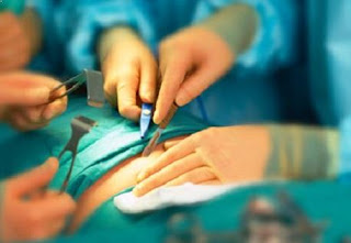  Operațiile chirurgicale din vise 