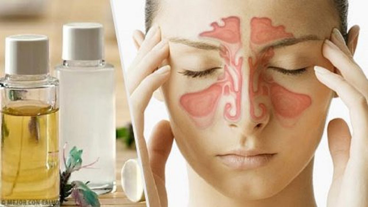 How To Naturally Treat Sinusitis (Easy Steps)