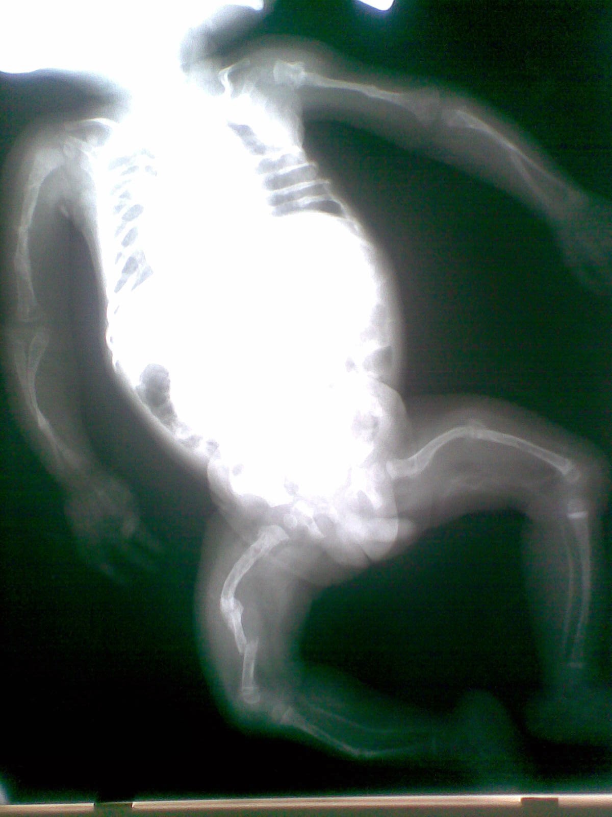 Beyond the Cross Brittle Bone Disease