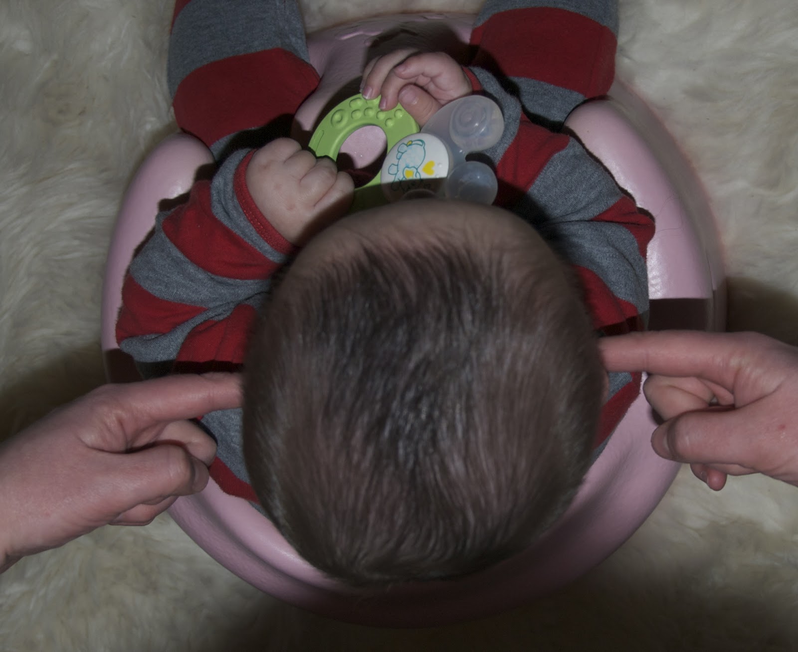 Plagiocephaly Treatment in the UK Evren's Before and After Helmet Photos