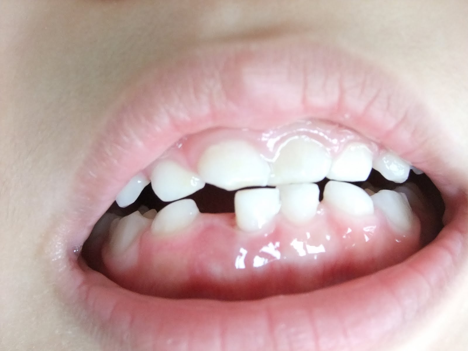 Prayers, Hugs & Diapers The Wobbly Tooth