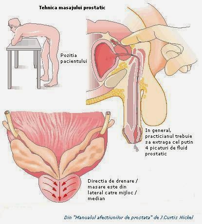 masajul prostatei cu penisul
