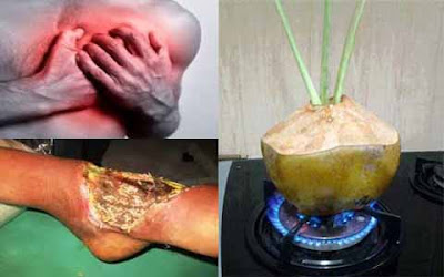 AKSES KESEHATAN | BERITA SEHAT | INFO SEHAT AKSES KESEHATAN | BERITA SEHAT | INFO SEHAT