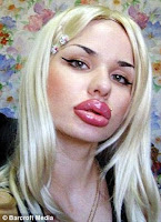 Woman desperate to look like Jessica Rabbit gets world's biggest lips after 100 injections (and she's not stopping there) 1