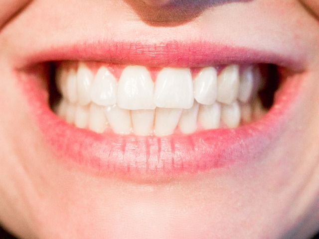 5 secretos para lograr unos dientes más blancos