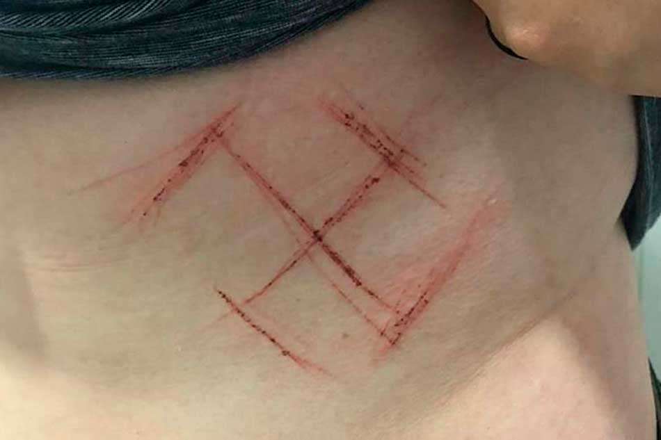 Polícia diz que jovem marcada com suástica foi vítima de homofobia