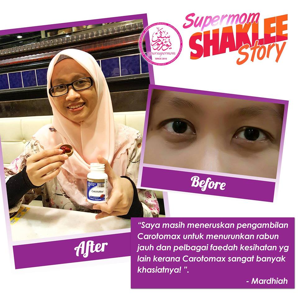 Cara Hilangkan Rabun Jauh Kenali Punca Rabun Jauh Dan Atasinya Dengan