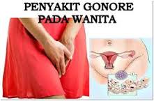Obat Kencing Nanah untuk Perempuan Paling Ampuh dan Manjur Obat Kencing Nanah untuk Perempuan Paling Ampuh dan Manjur