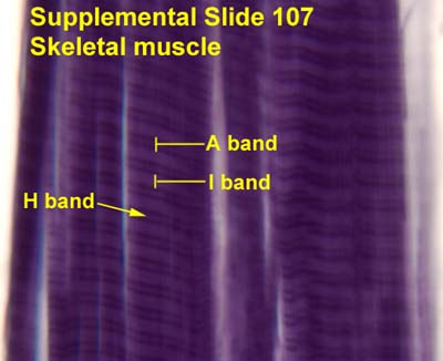 HISTOLOGY PICTURES: Muscle