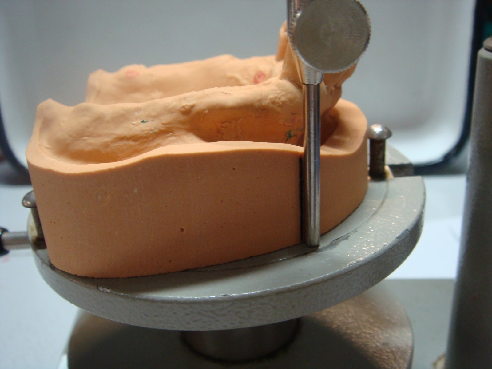 Understanding Prosthodontics Tagore Dental College & HospitalBy