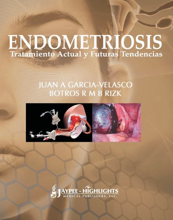 Endometriosis.Tratamiento Actual y Futuras Tendencias