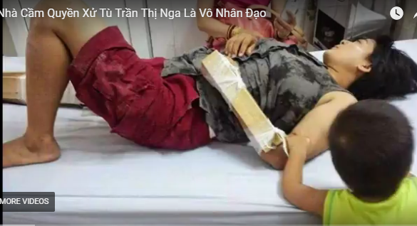 VNTB – Nhà cầm quyền xử tù Trần Thị Nga là vô nhân đạo