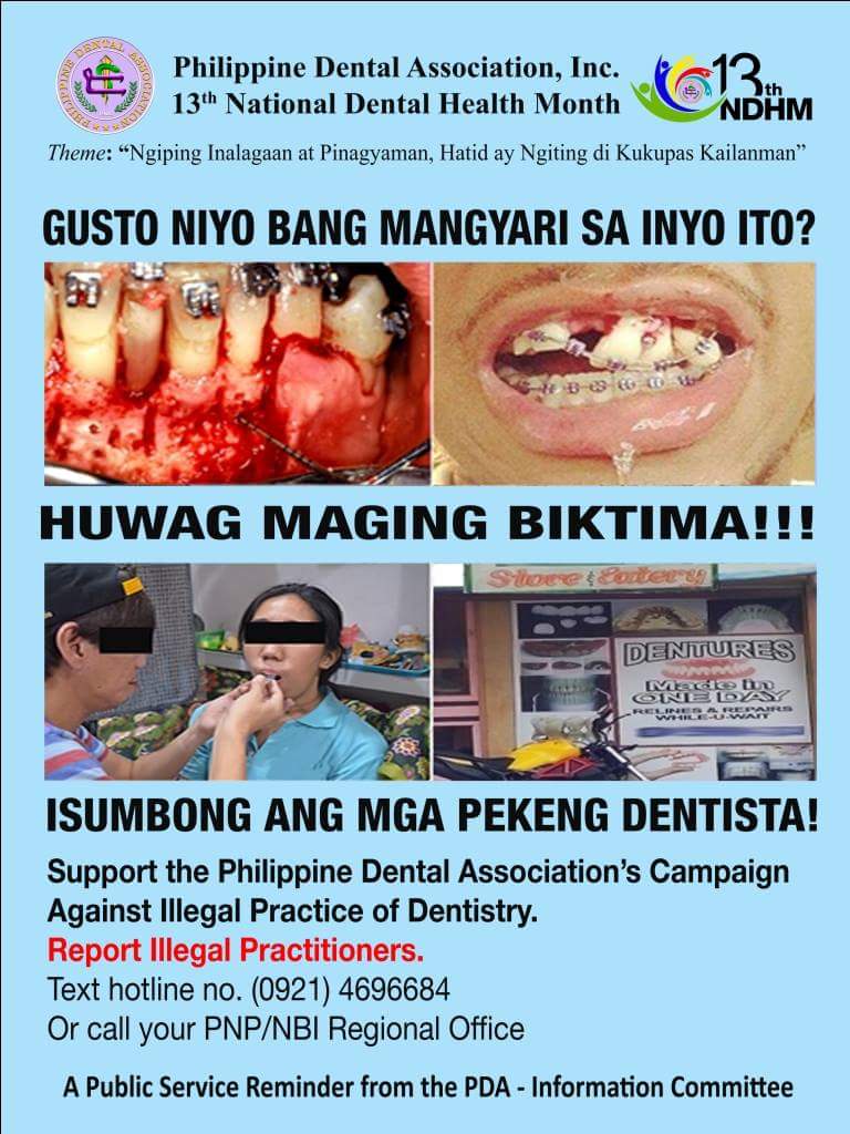 Isumbong ang mga Pekeng Dentista - Ngipin atbp...