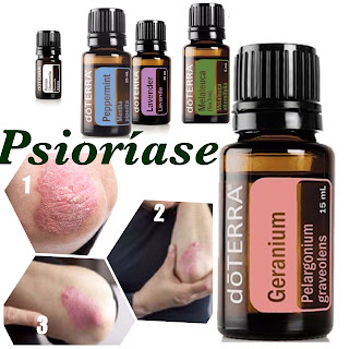 Óleos essenciais dõTerra