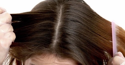 remedios caseros psoriasis cuero cabelludo tratamiento de la psoriasis del cuero cabelludo con remedios caseros psoriasis cuero cabelludo tratamiento de la psoriasis del cuero cabelludo con