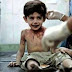 MUNDO / “Quando eu morrer, vou contar tudo a Deus”, afirma criança vítima da guerra na Síria