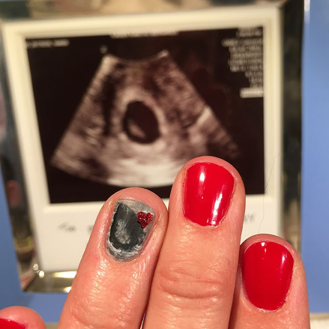 The New Fashion For Pregnant Women Is To Have Her Nail Ultrasound Painted