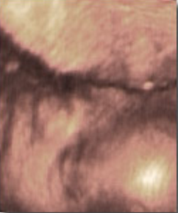 Hafta hafta bebeğin ultrason görüntüleri-25.hafta