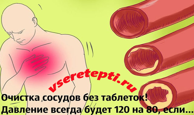 матрица очищения сосудов