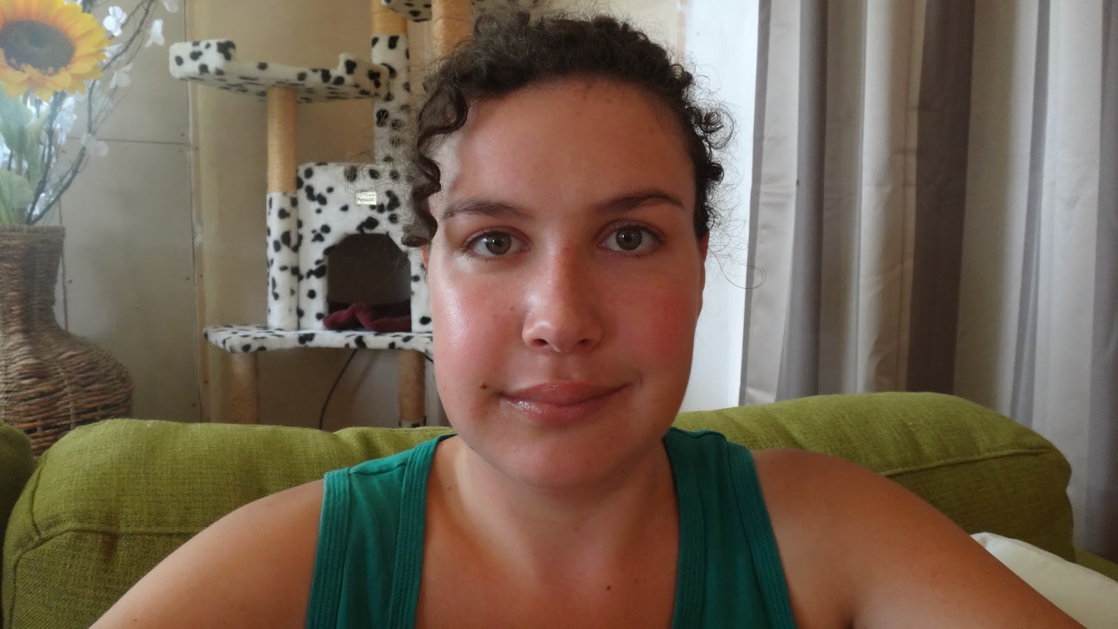 Kelsie's Jaw Surgery Day 8 The Lopsided Face