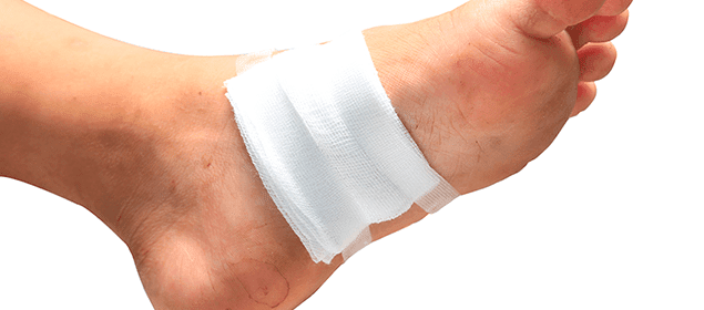 como curar heridas en el pie diabetico como curar heridas en el pie diabetico