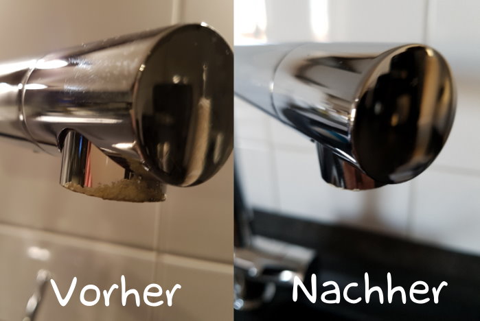 Muckenstich Wird Blau Blaue Flecke Durch Muckenstiche