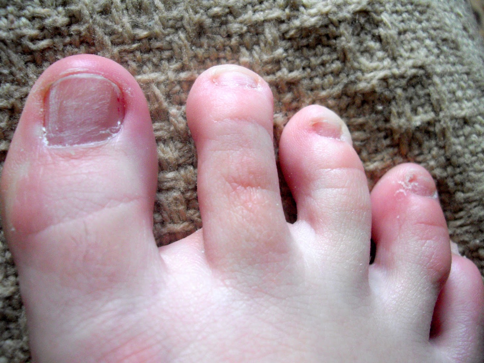 Kathy Leonia 1215 Jak Dbac O Paznokcie U Stop