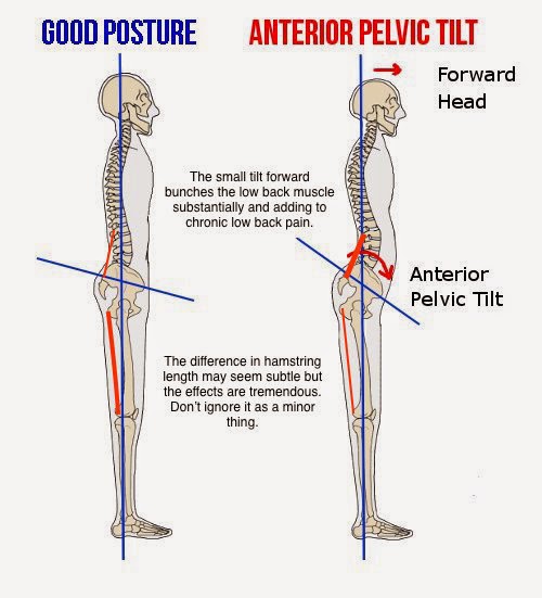 Total Athletic Therapy Hamstrings Tight vs. Taut