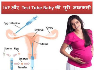 ivf-test-tube-baby-in-hindi-full-information
