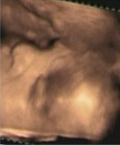 Hafta hafta bebeğin ultrason görüntüleri-36.hafta