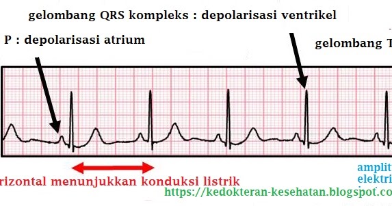 Bagaimana Gambaran EKG Yang Normal Itu? - KLIK INSTAL