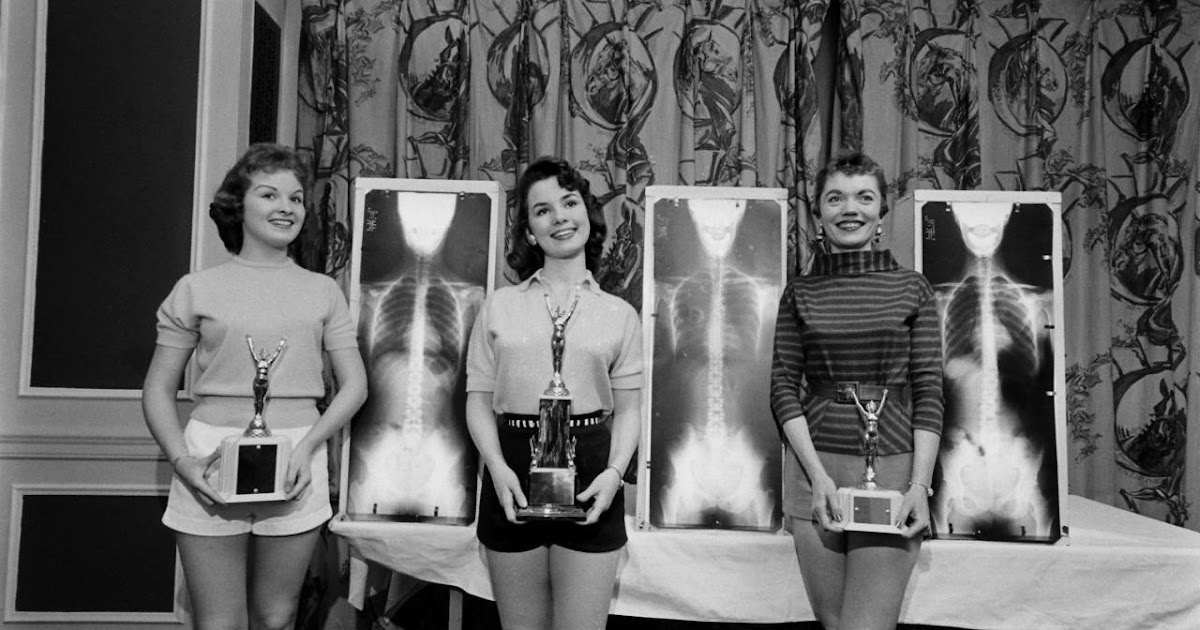 Miss Correct Posture Pictures From a Chiropractor's